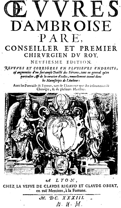 ambroise pare hydrocephalus 1